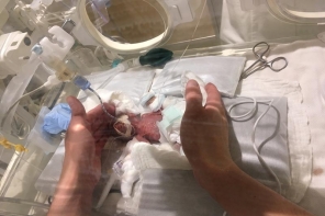 World smallest Boy Baby